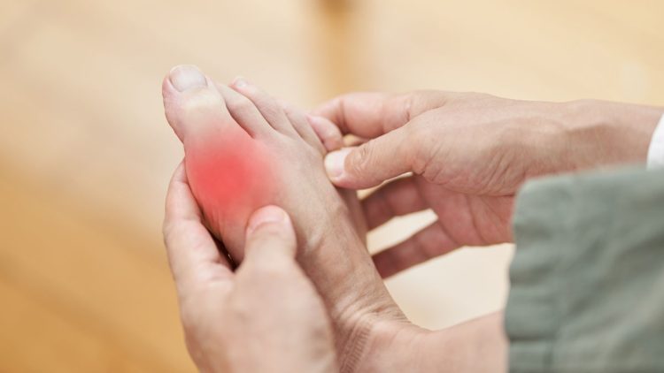 What is Gout?