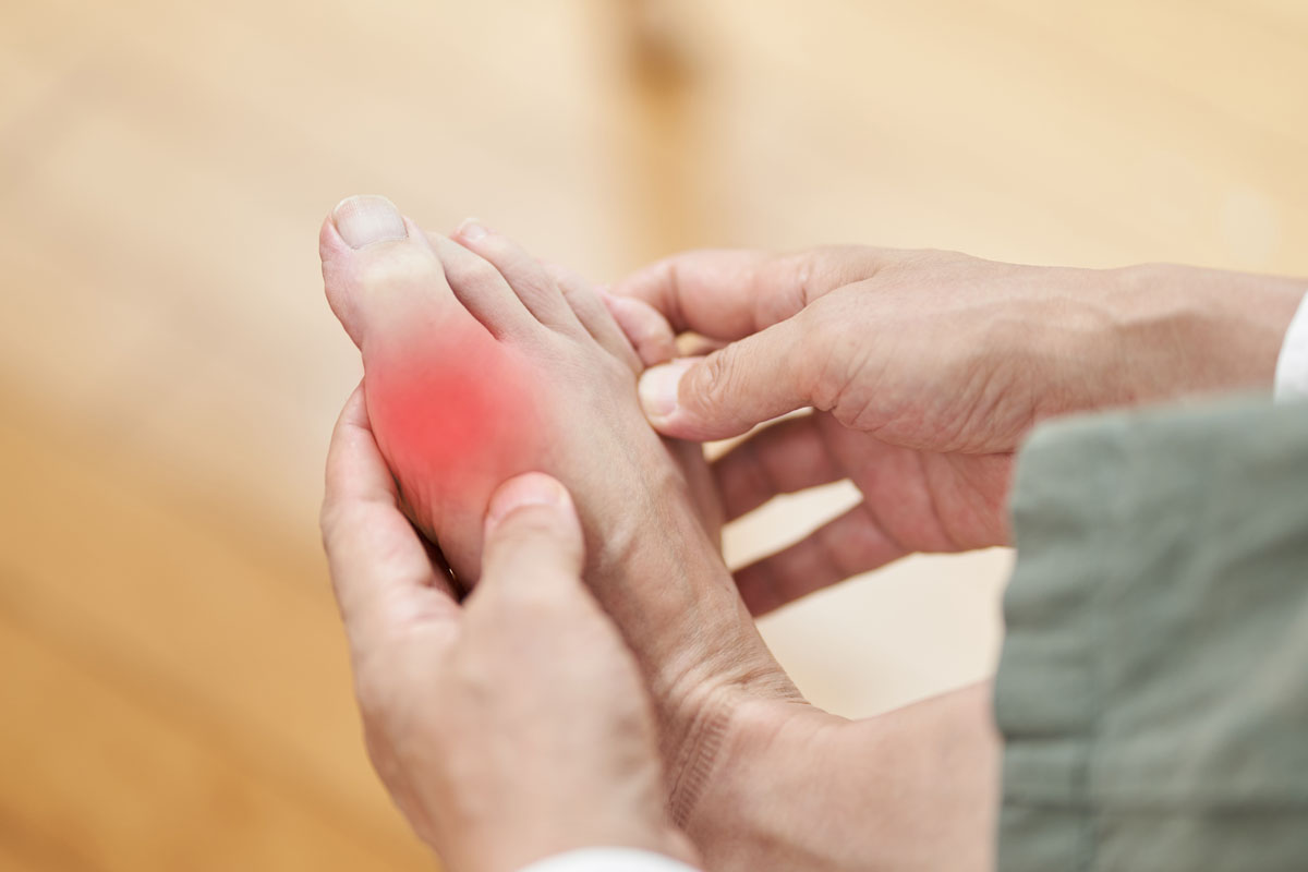 What is Gout?