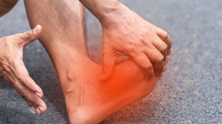 Plantar Fasciitis