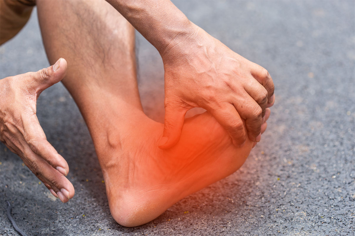 Plantar Fasciitis